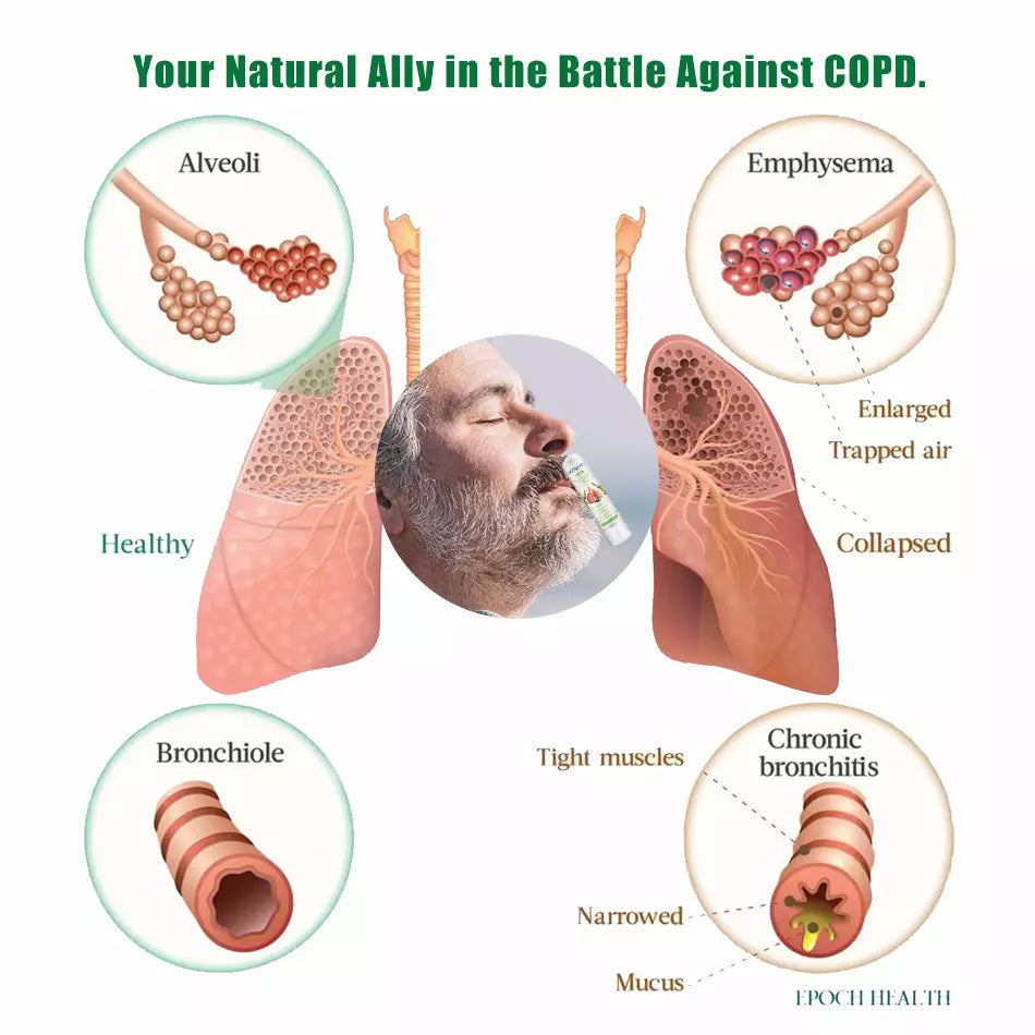 NoseFree™: Revolutionary Natural Solution for COPD Relief and Lung Health