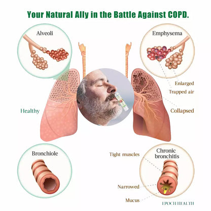 NoseFree™: Revolutionary Natural Solution for COPD Relief and Lung Health